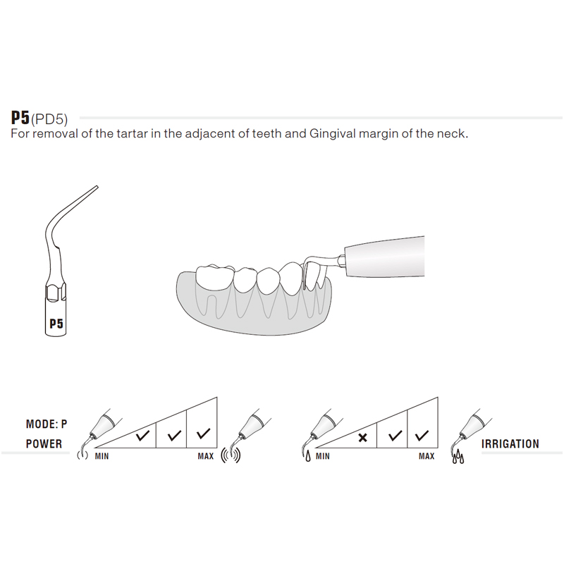 Punta ultrasonidos Woodpecker DTE PD5, rosca tipo S y comp. | Perio