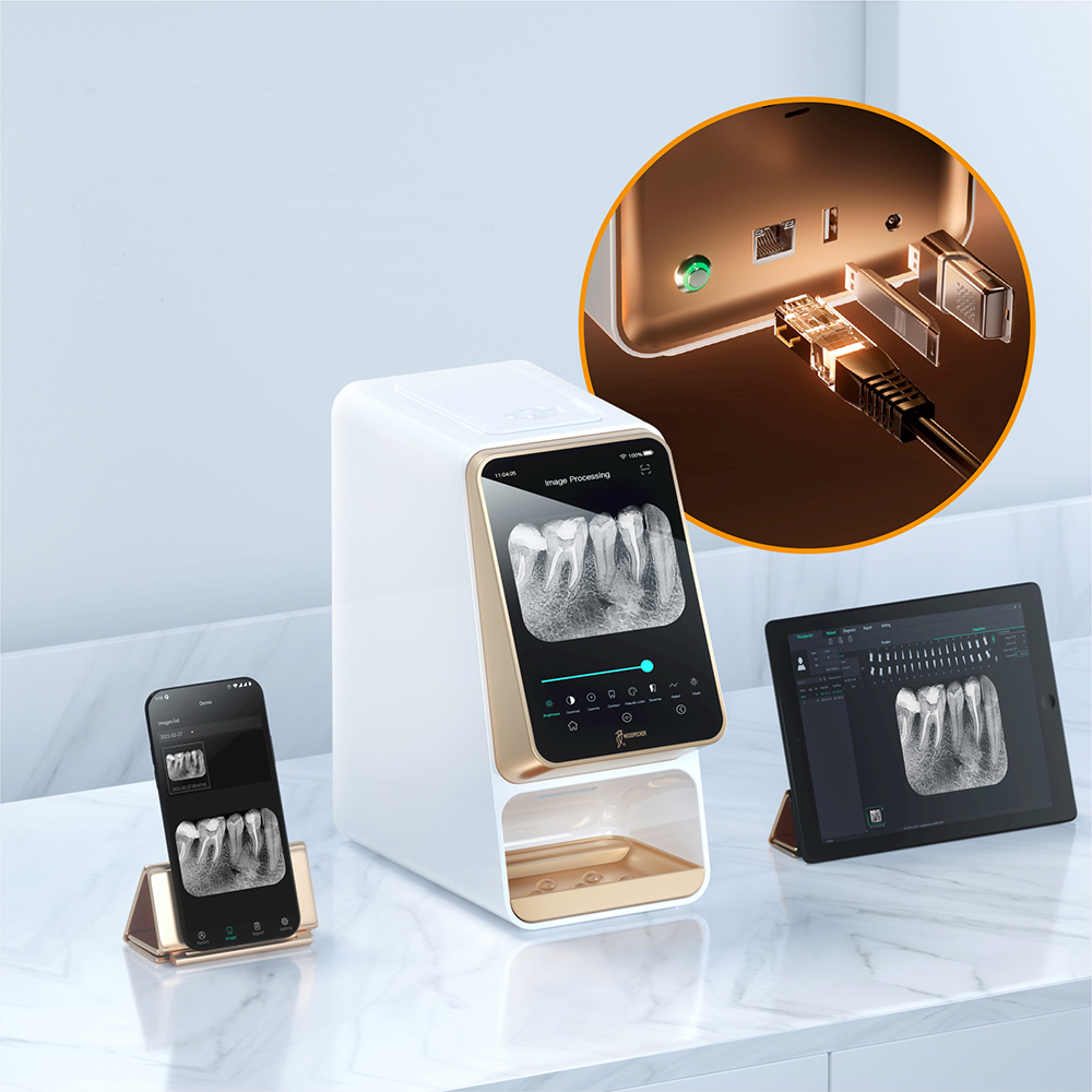 Escáner de placas de fósforo i-Scan | UPGRADE