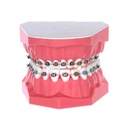 Tipodonto de Demostración con Brackets adulto 32 dientes